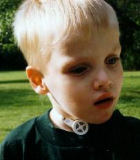Child with a Tracheostomy