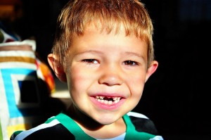 Child Missing Front Teeth