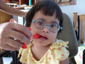 Child with Hypotonia