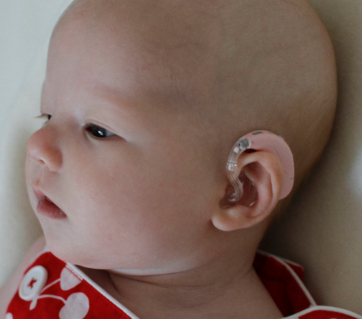 Baby with Hearing Aid