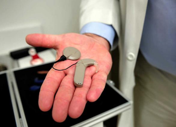 External Parts of Cochlear Implants