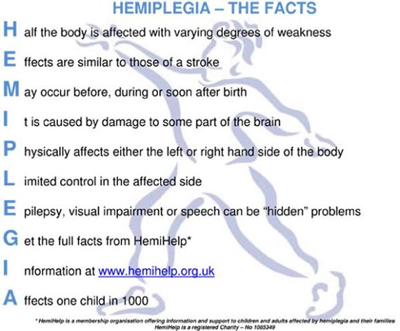 hemiplegia