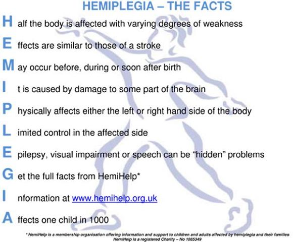 Hemiplegia