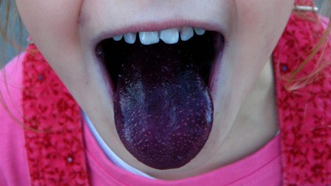 Build Reading Skills in Kids with Expressive Language Disorder Build Reading Skills in Kids with Expressive Language Disorder